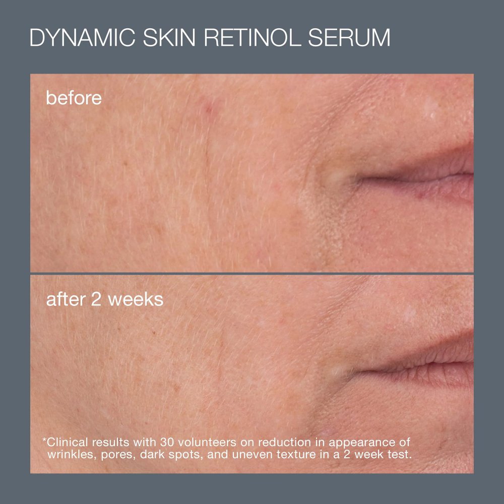 Dynamic Skin Retinol Serum Reduces Signs of Skin Aging